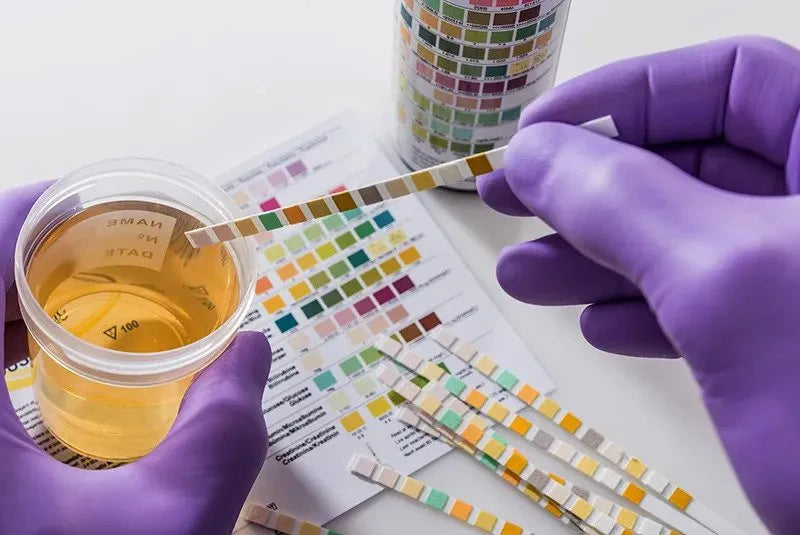 Urine Drug Tests - MedNZ Drug Testing New Zealand